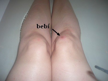 bebko